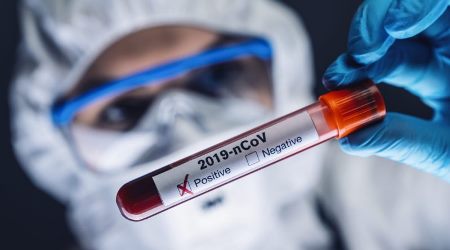 SOS: Gündəlik yoluxma sayında yeni rekord